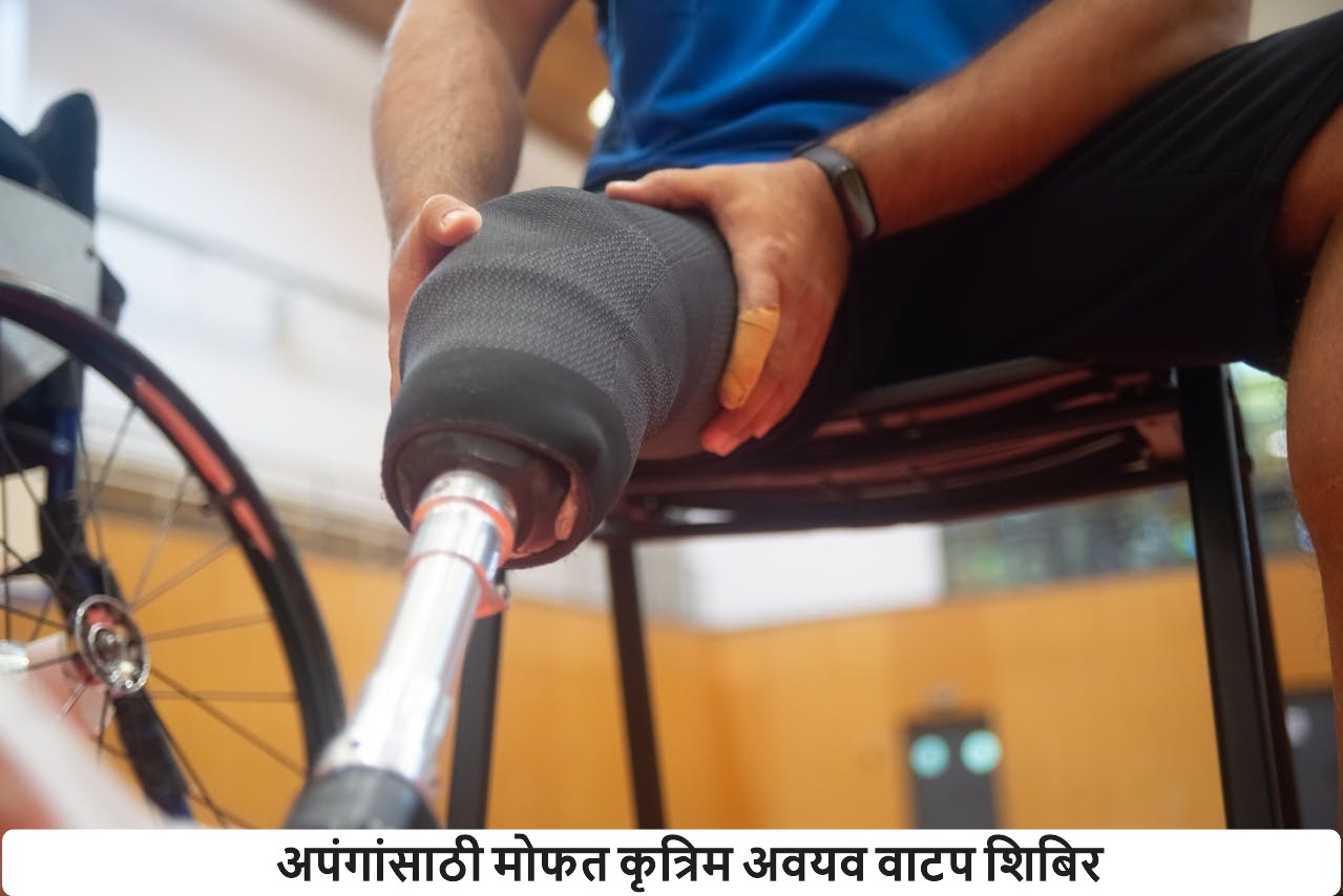Free Artificial Limb Distribution Camp for the Disabled